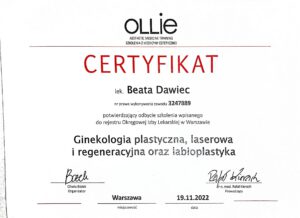 Labioplastyka